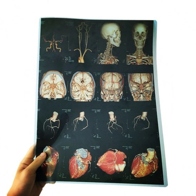 Radiology медицинская сухая струйная рентгеновская пленка для больничного пленочного принтера