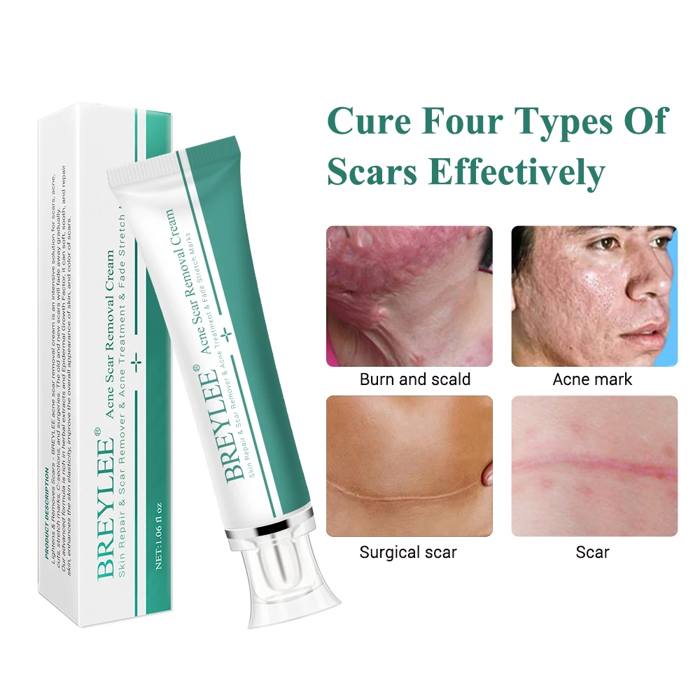 Крем для удаления шрамов от акне BREYLEE Stretch mark