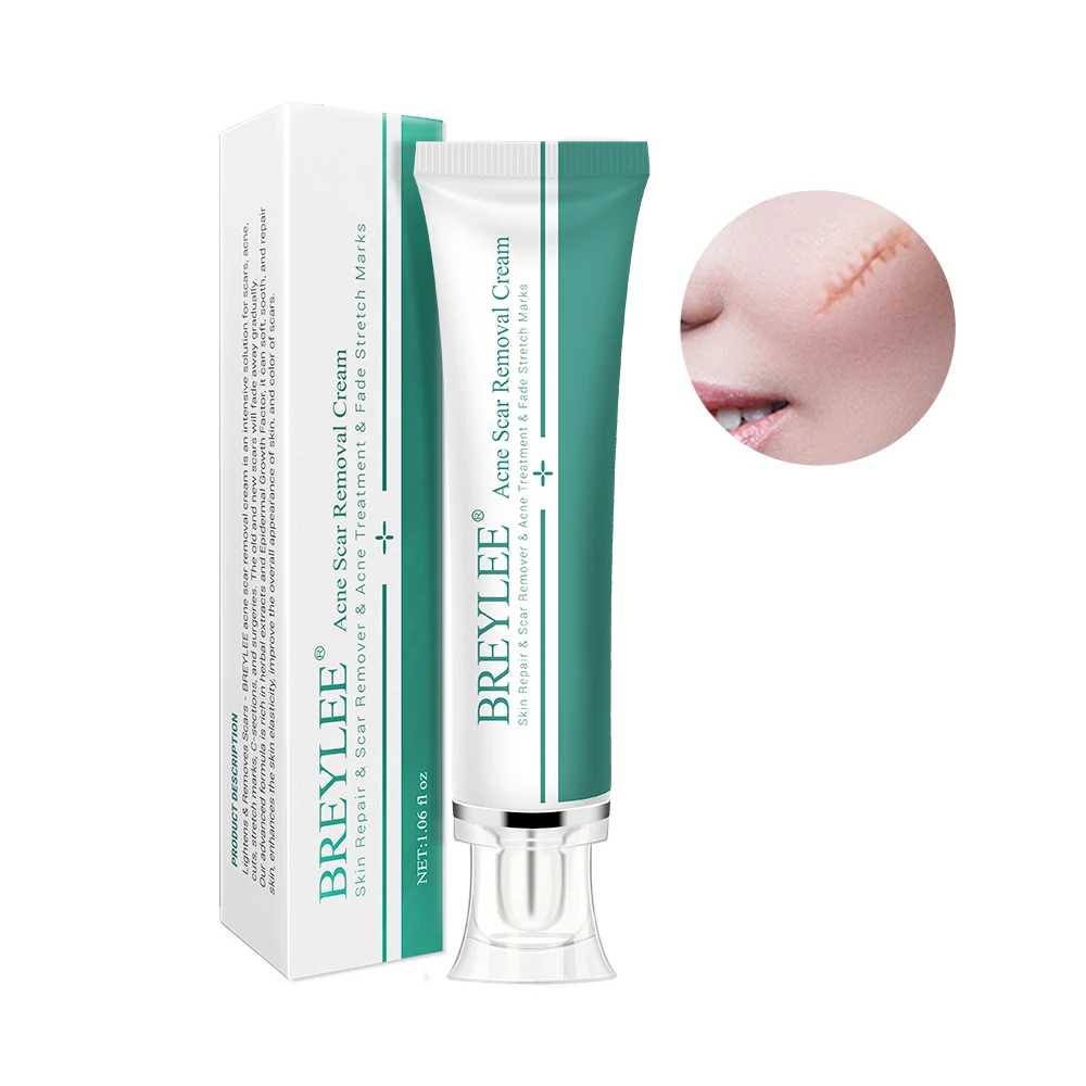 Крем для удаления шрамов от акне BREYLEE Stretch mark