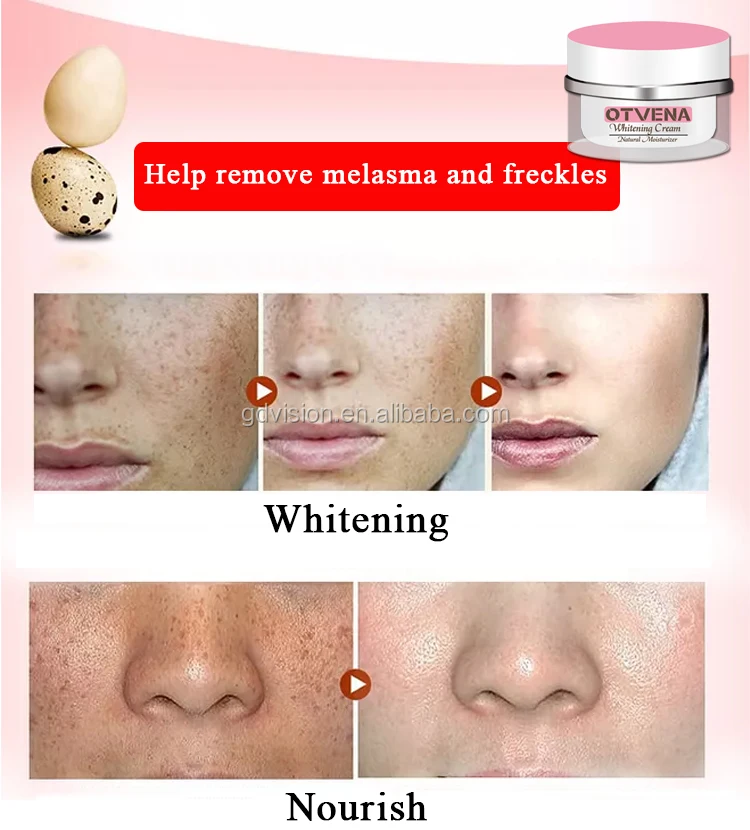Hot sell OTVENA face milk quick skin whitening body cream in south korea