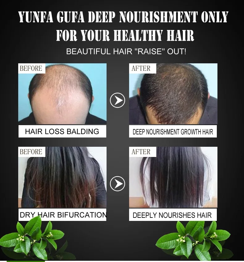 OEM 100%  Natural plant extract Hair conditioning hair growth herbal medicine repair hair blemishes