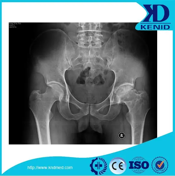 
KND A/F Dry X Ray Film for DSA/MRI Agfa Medical Fuji Diat Thermal Flim 