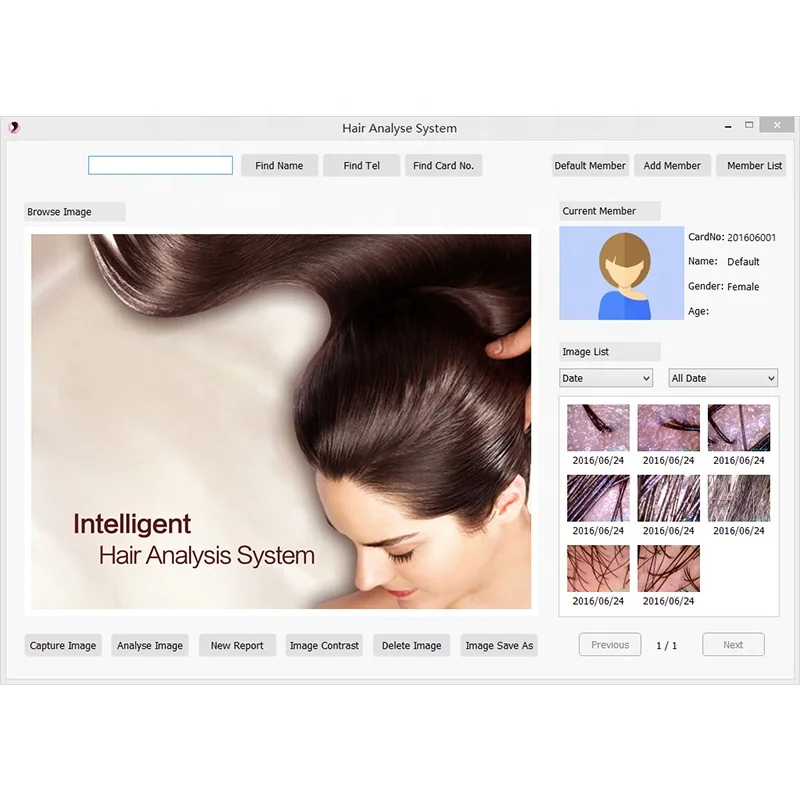 High Quality 8.0 MP HD USB Hair Scalp Scope analyzer