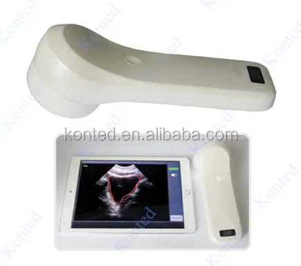 Portable Bladder Scanner / Wireless 4d Ultrasound Bladder Scanner / Bladder Scanner Price