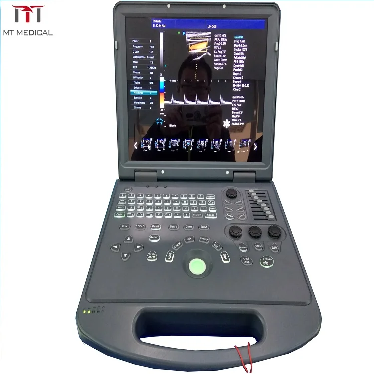
Medical Portable Doppler Ultrasound Machine 