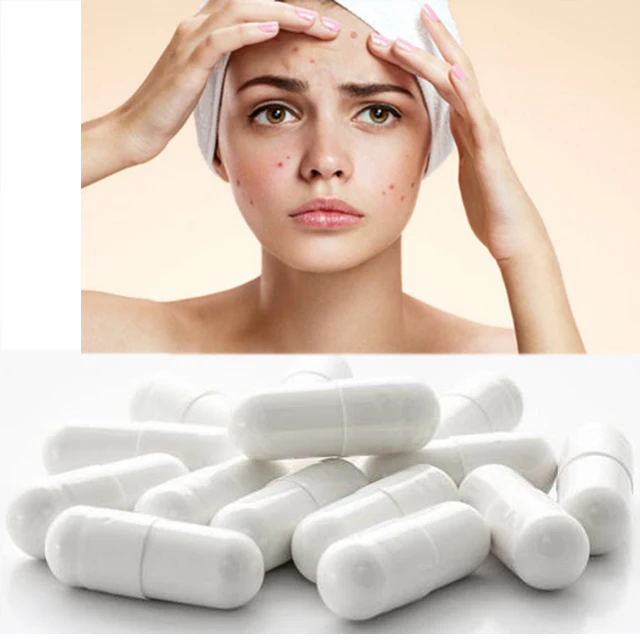 Herbal Effective Anti Acne Skin Whitening Honeysuckle Gluta thione Pills Capsules