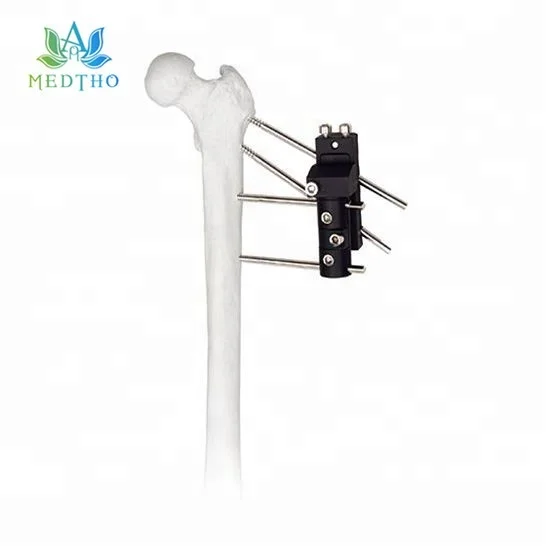 orthopedic external fixation types of external fixators Hip Joint Traction External Fixator