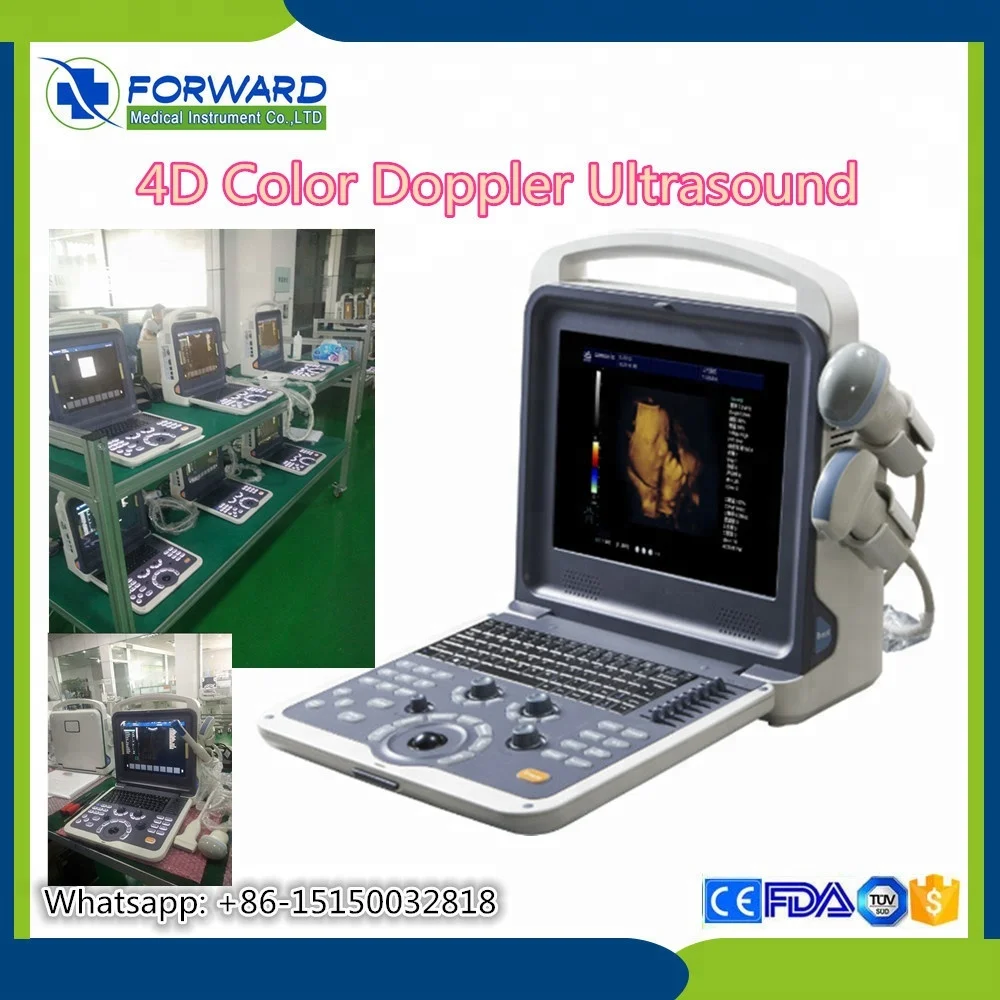 ultrasound machine/Hand-carried Portable Color Ultrasound Doppler for hospital