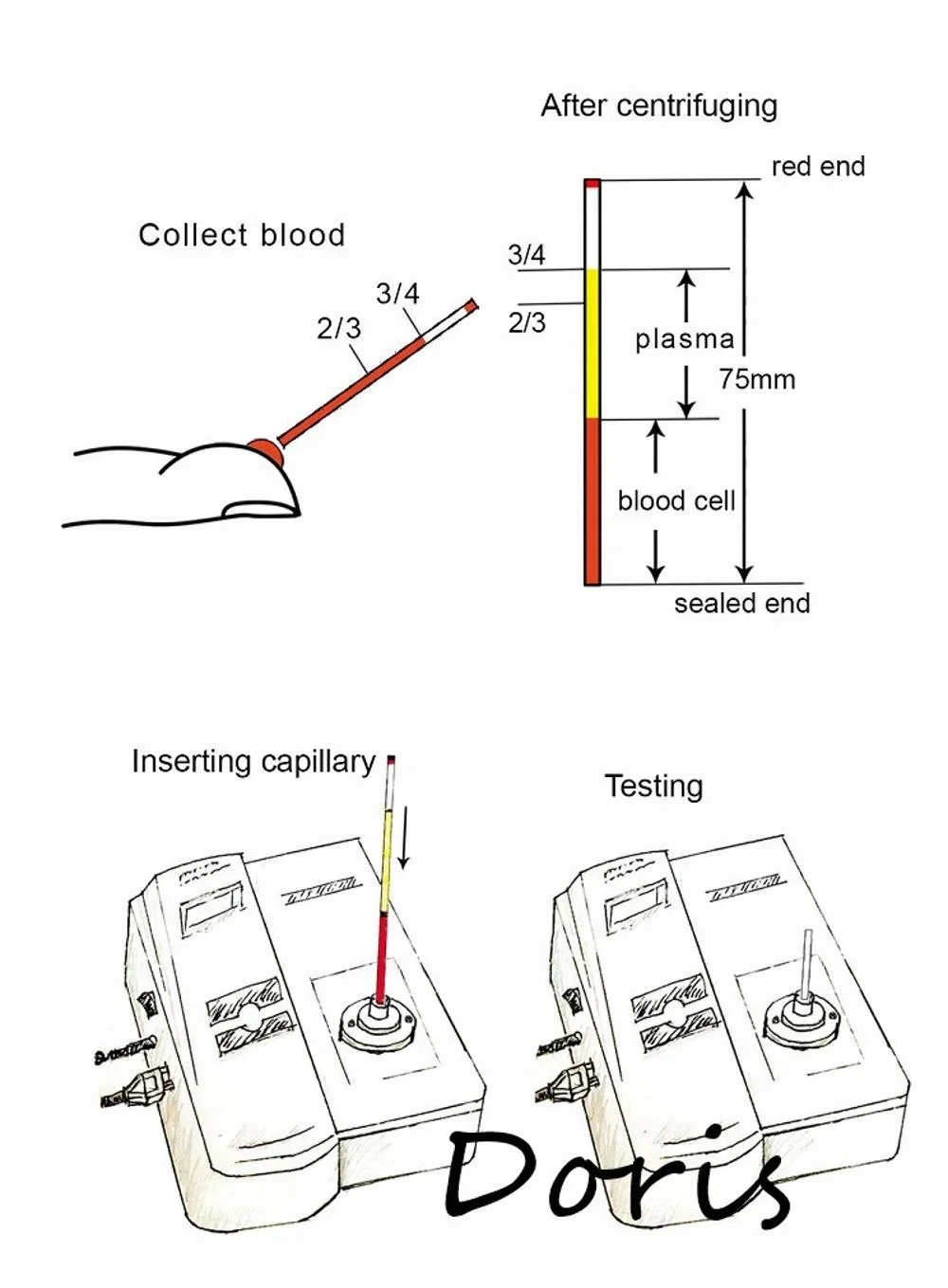 
Portable Percutaneous Bilirubin Meter/percutaneous jaundice meter 