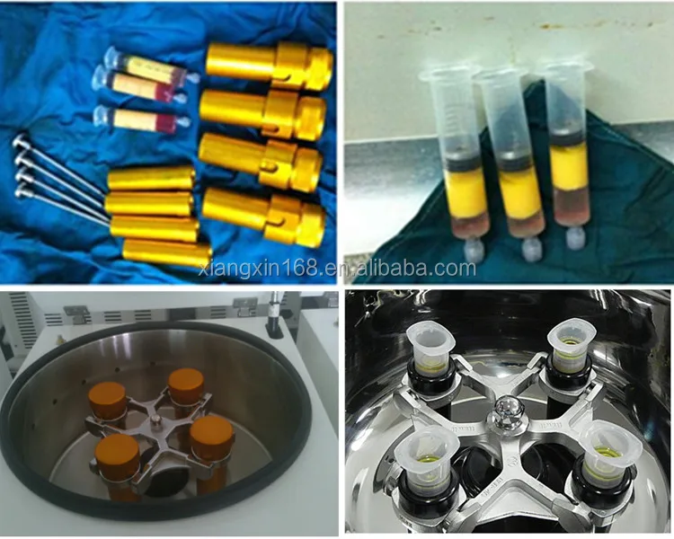 60/50ml Syringe bucket Platelet rich plasma transfer centrifuge fat Transfer low speed centrifuge TD4-ZF