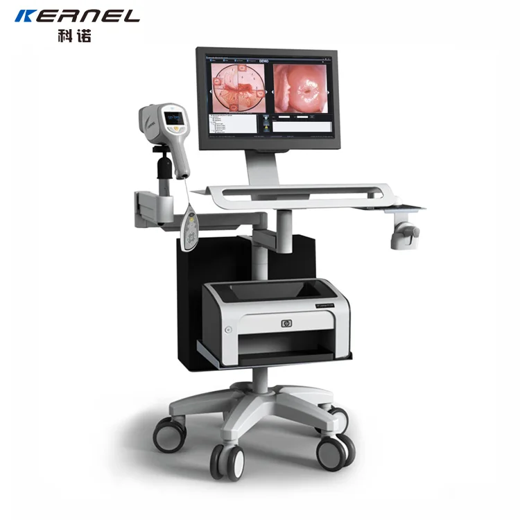 Ядро KN-2200I HD Цифровая видеокамера кольпоскоп система визуализации