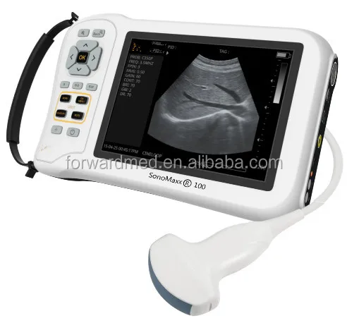 Portable Ultrasonic Diagnostic Devices Type Laptop ultrasound scanner/ usb ultrasound probe for laptop