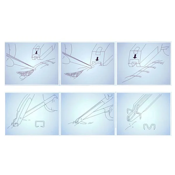  Высококачественный одноразовый степлер для кожи 35 Вт с CE