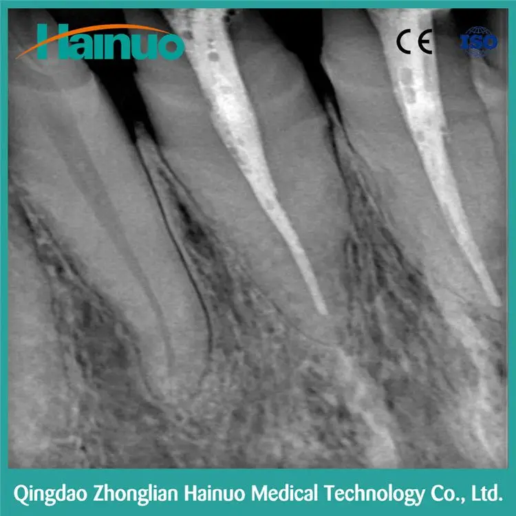 
Hot Sale HDR Intraoral Digital X-ray Radiologic Dental 