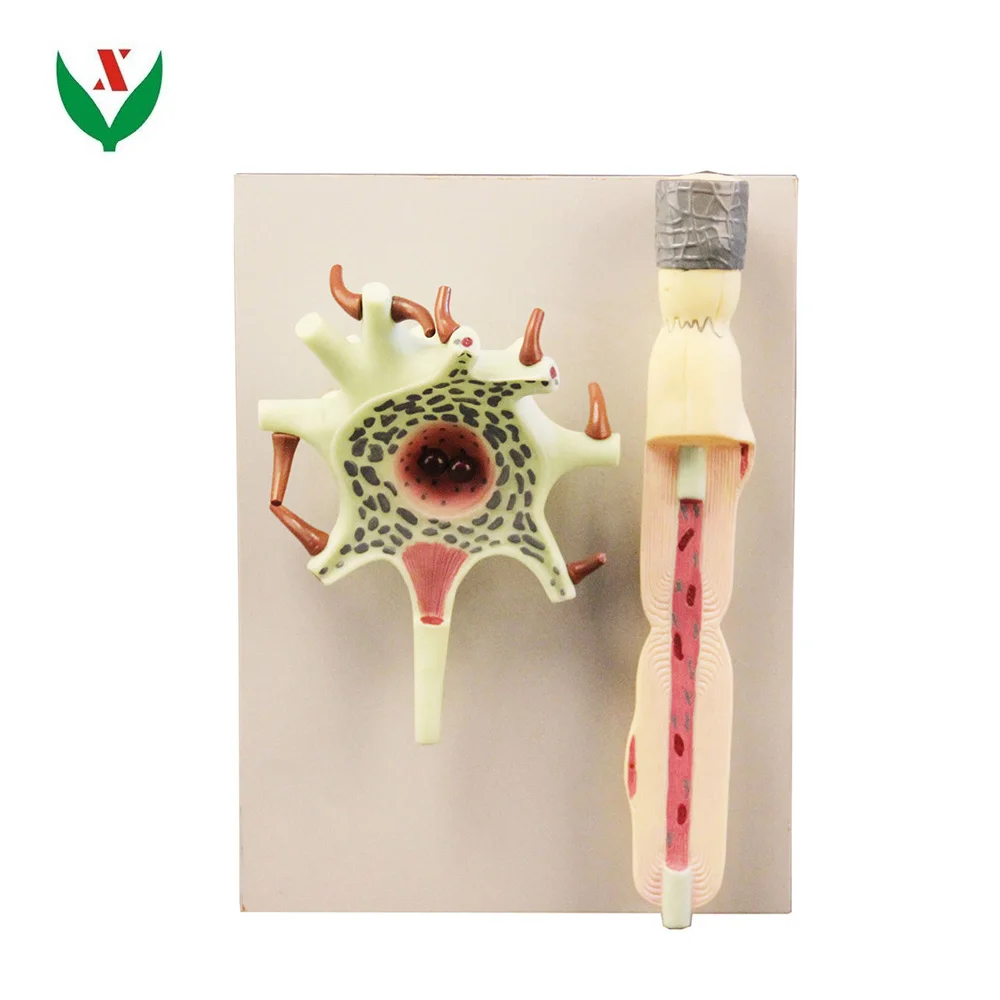 Scientific Human Anatomy - Neuron Model 2500-fold Magnification of Neuronal Cell Body and Nerve Fiber Structure Amplification