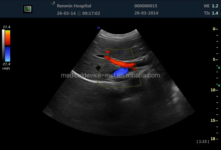 Аппарат USG по разумной цене Ультразвуковой доплеровский сканер 4D для продажи (MSLCU24)