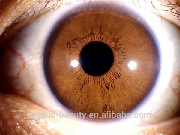 AYJ-J013 iridology equipment Mini USB Analysis Machine