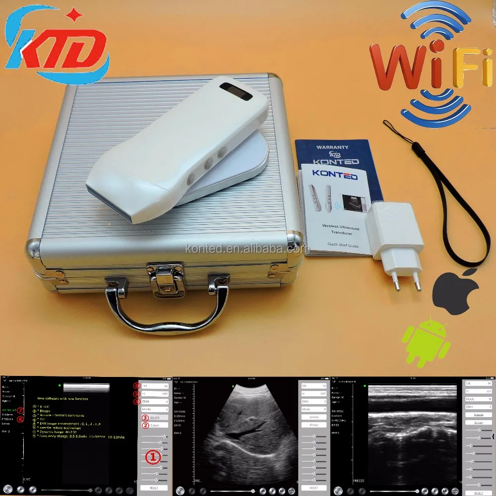 Беспроводной ультразвуковой зонд Ipad с 128 элементами, ультразвуковой сканер для теста на беременность