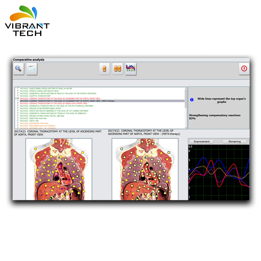 25d nls health analyzer metapathia gr hunter/metatron hunter 4025
