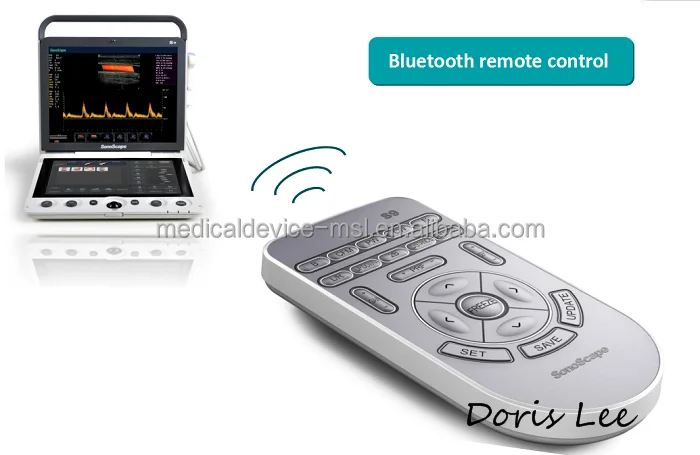 Новейшая модель портативная цветная допплеровская ультразвуковая машина SonoScape S9 цена