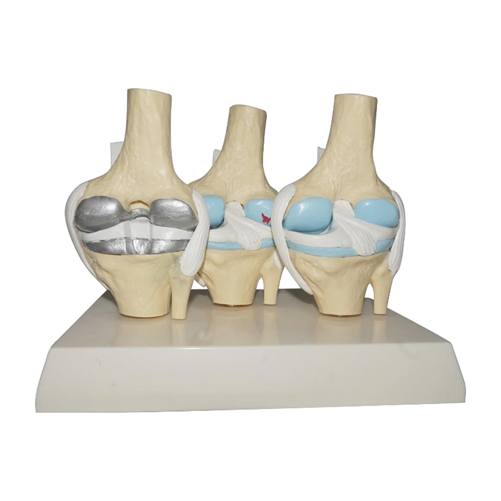 Human Knee Joint and Skeletal Anatomical Teaching Model