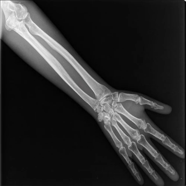 x ray film for AGFA drystar 5302 DT2B