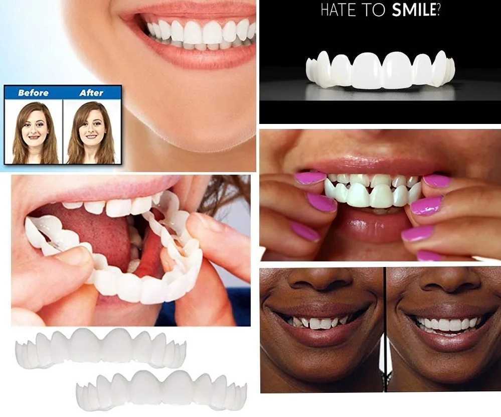 
white instant smile 