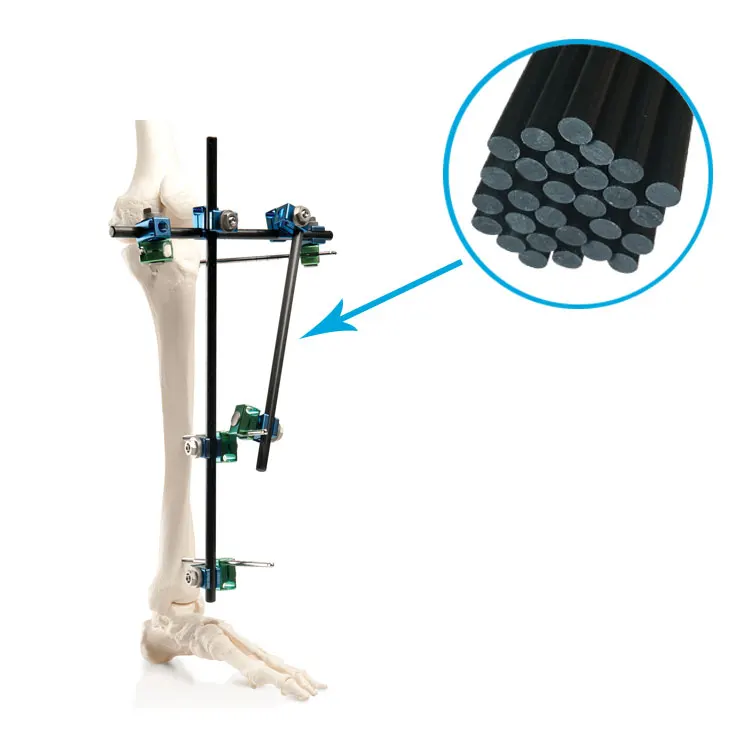 Large Bone Temporary External Fixation System 5mm 8mm 11mm 12mm carbon fiber rods