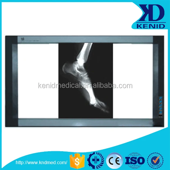 
Xray LED Viewing Box LED Medical X Ray Film Negatoscope LED X Ray Film Viewer 