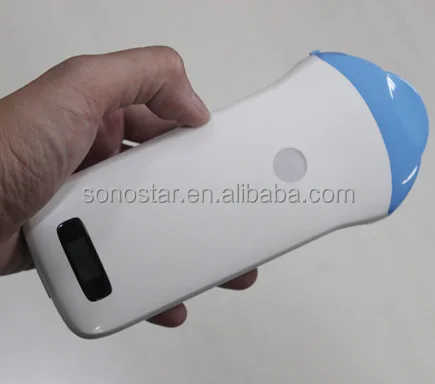 Manufacturer supply wireless probe ultrasound for mobile phone and tablet