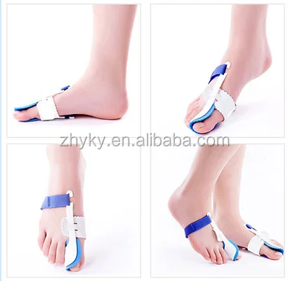 Blue hallux valgus orthotics