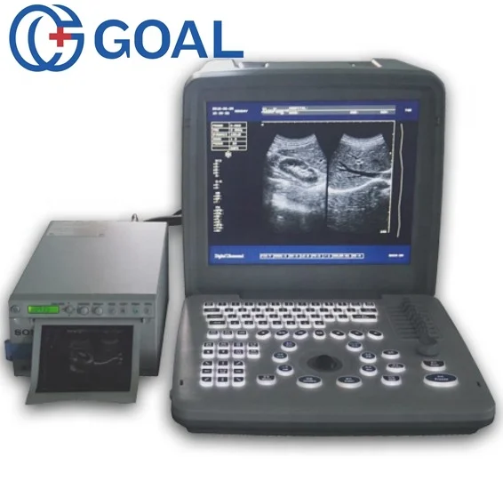 digital ultrasound machine price/ doppler ultrasound