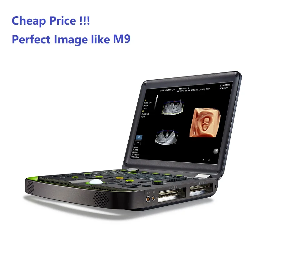 Цветной Допплер для ноутбука site-rite сосудистый ультразвуковой медицинский инструмент портативная ситеритовая Диагностическая ультразвуковая