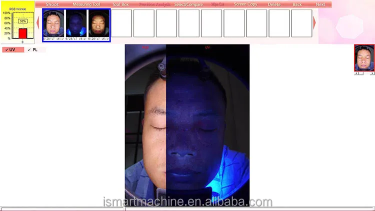 High end Facial skin analyzer portable with best price