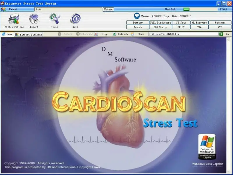 
DMS cardioscan stress test ecg software medical treadmill equipment 