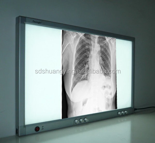 LED Film Viewer/aluminum x ray film viewer