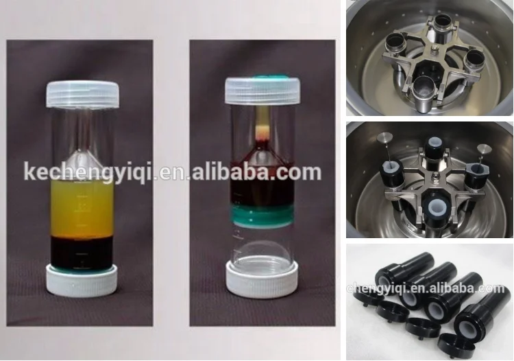 L3-5KM PRP PPP извлечения стволовых клеток разделения самостоятельно жира трансплантата центрифуга для салона красоты пластиковые больницы