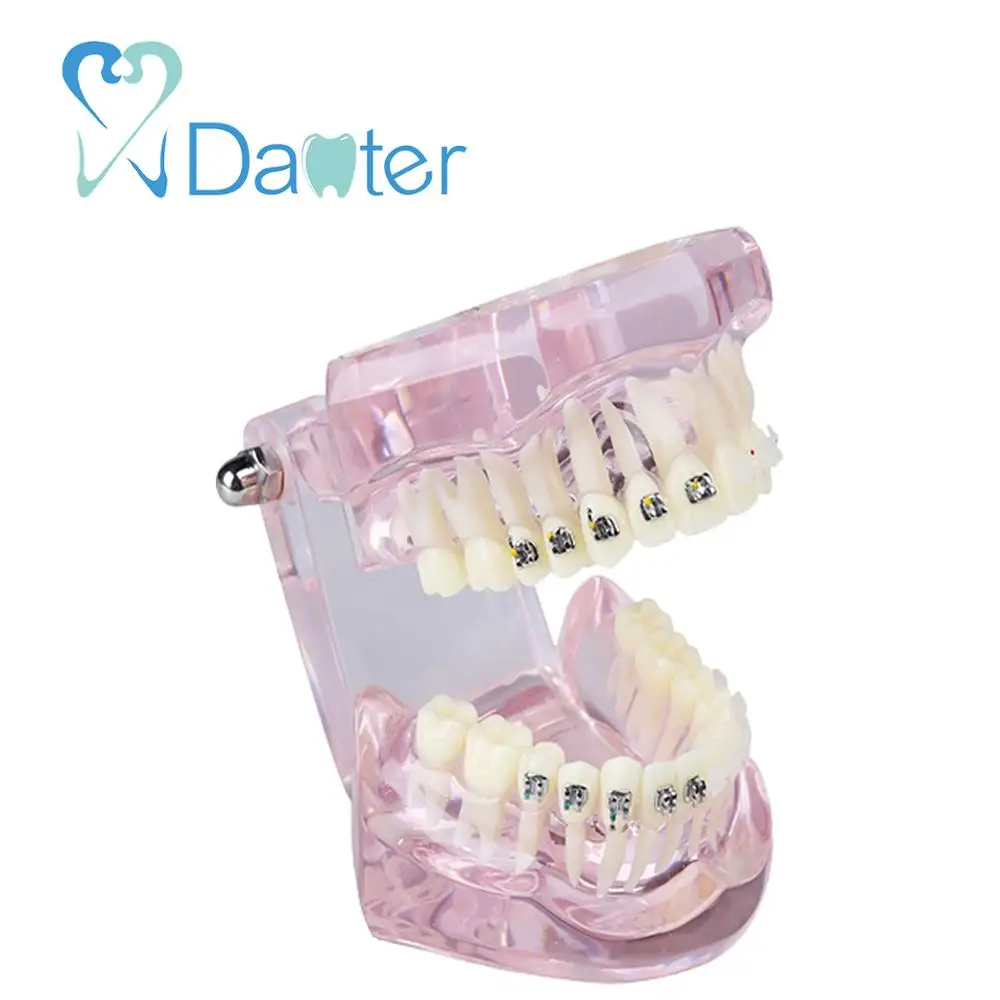 New Arrival Dental Orthodontic Model with Metal and Ceramic Bracket