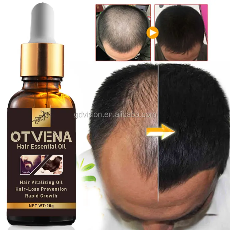  hair growth serum anti loss product OTVENA oil
