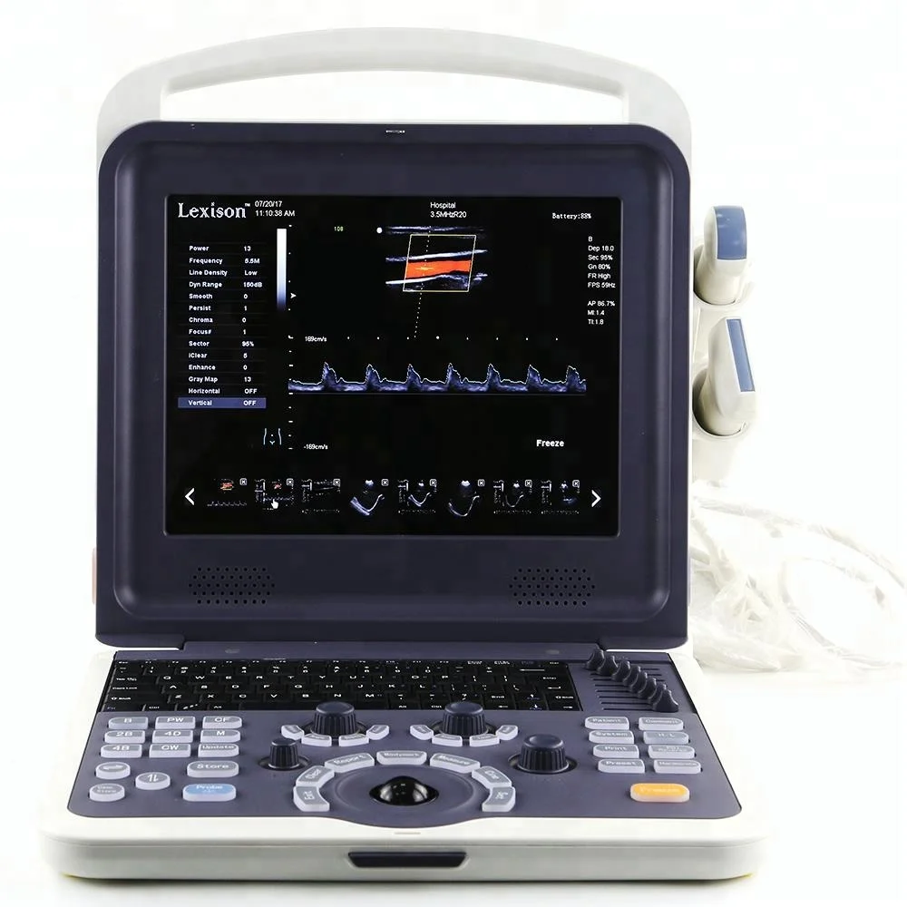 PRUS-WK60 High Quality Veterinary Color Doppler Veterinary Ultrasound Machine