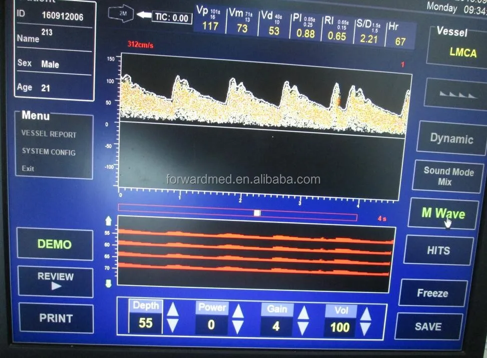 Transcranial Doppler Testing Equipment, Transcranial Doppler Tcd
