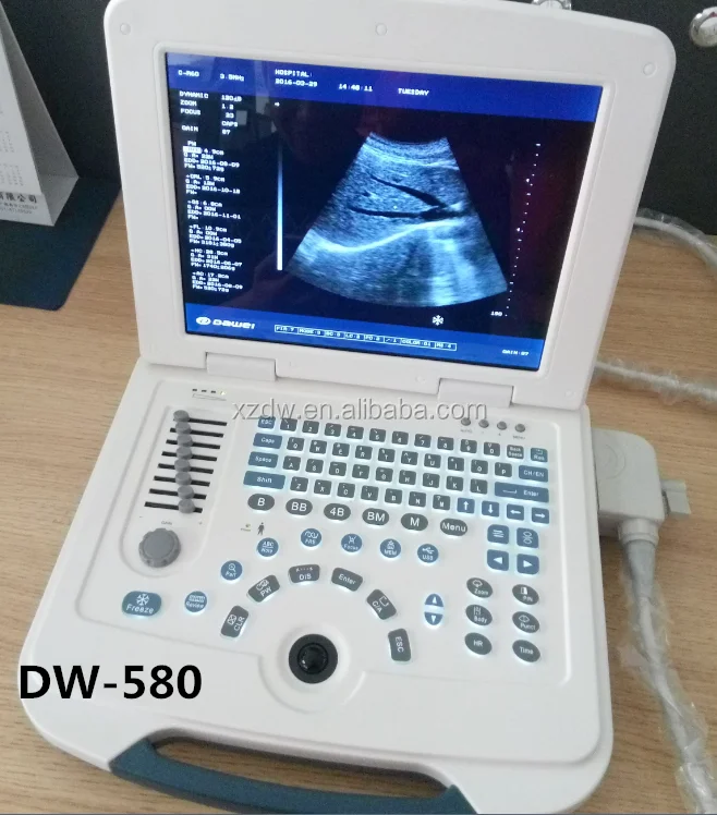 Dawei low price portable ultrasound scan machine for pregnancy DW580