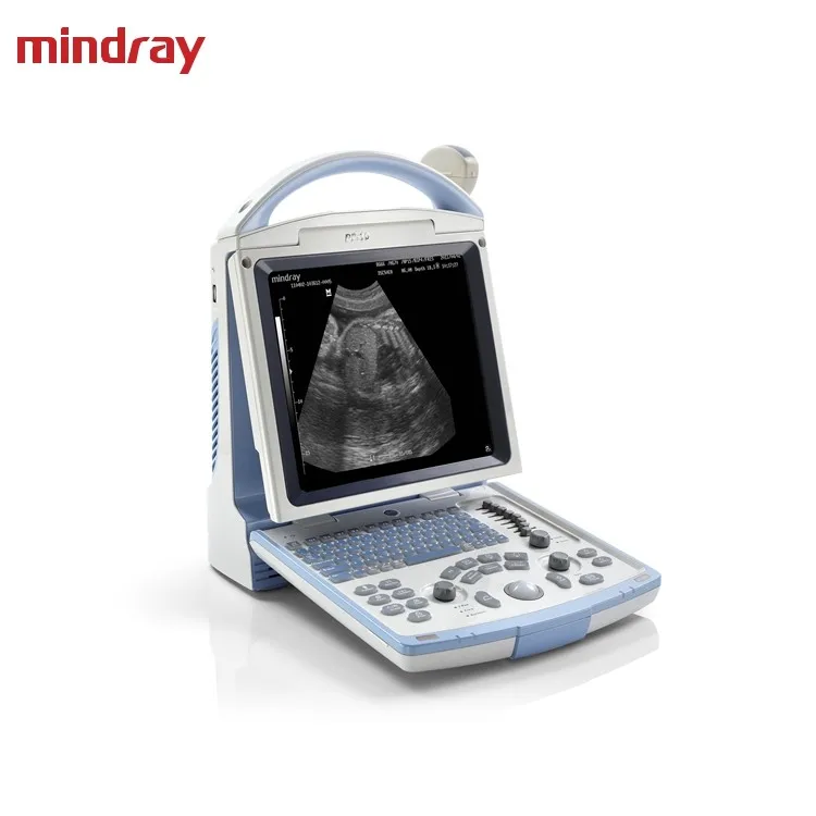 
Cheapest Smart Portable Ultrasound machine Mindray DP 10 , Diagnostic Ultrasound system for hospital  (62012781618)