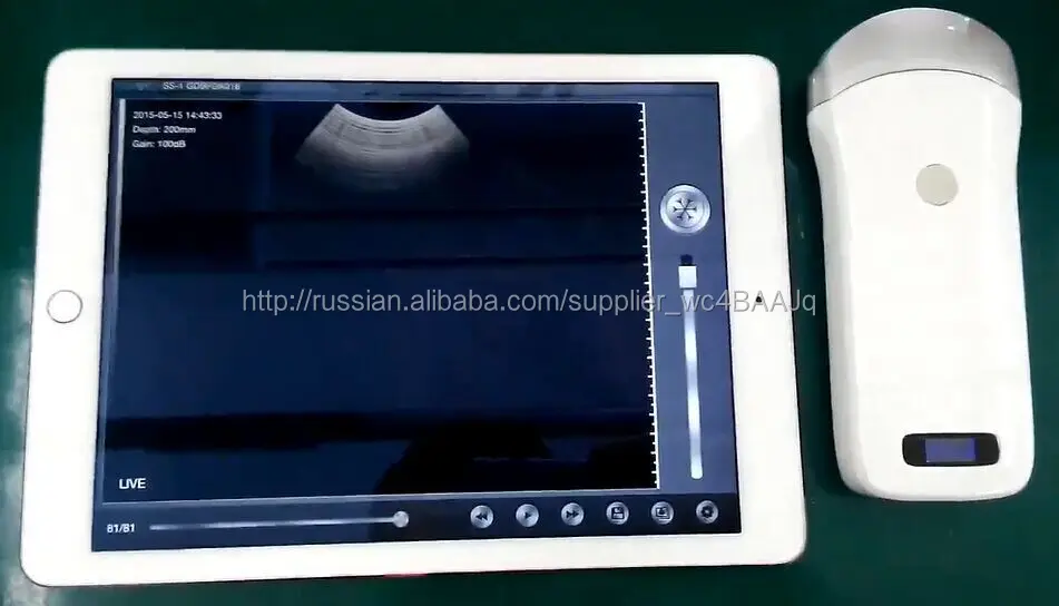 Горячая распродажа полный карманные узи с конвексный датчик для ipad