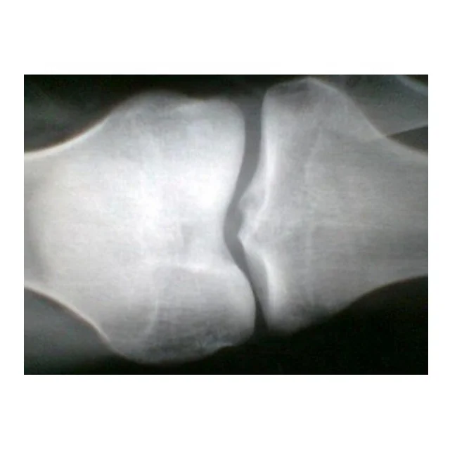 
 Wholesale Dry Thermal Medical Film Blue Color fuji film  
