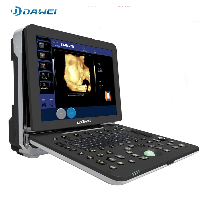 New laptop and portable 3D 4D Color Doppler Veterinary Ultrasound DW-P6(DW-C300) can exam cardiac