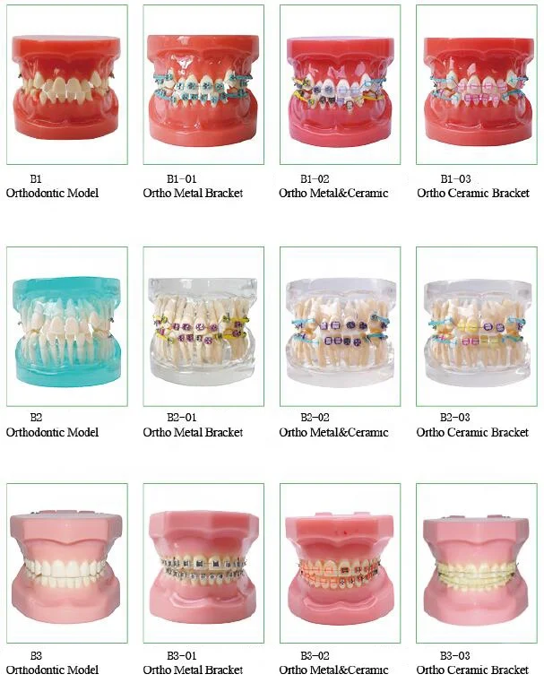 Dental Ortho teeth model