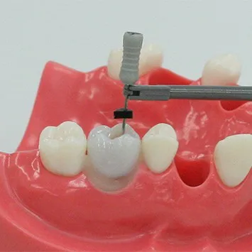 Standard teeth model with 28pcs screw in replaceable teeth for practice preparation