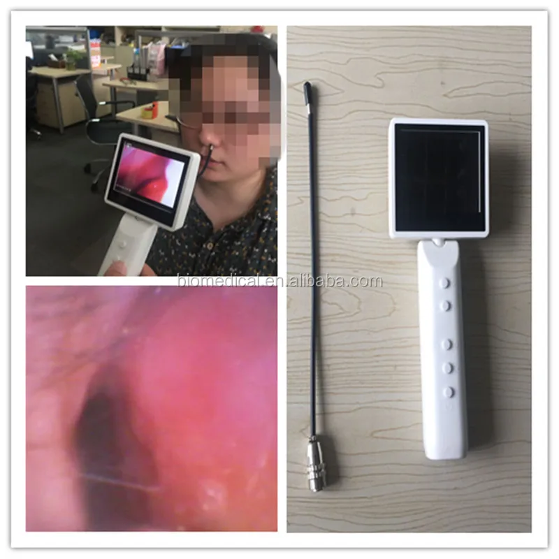 
Video Endoscopy ENT Surgical Instruments ENT Treatment Unit For Ear Throat Nasal 