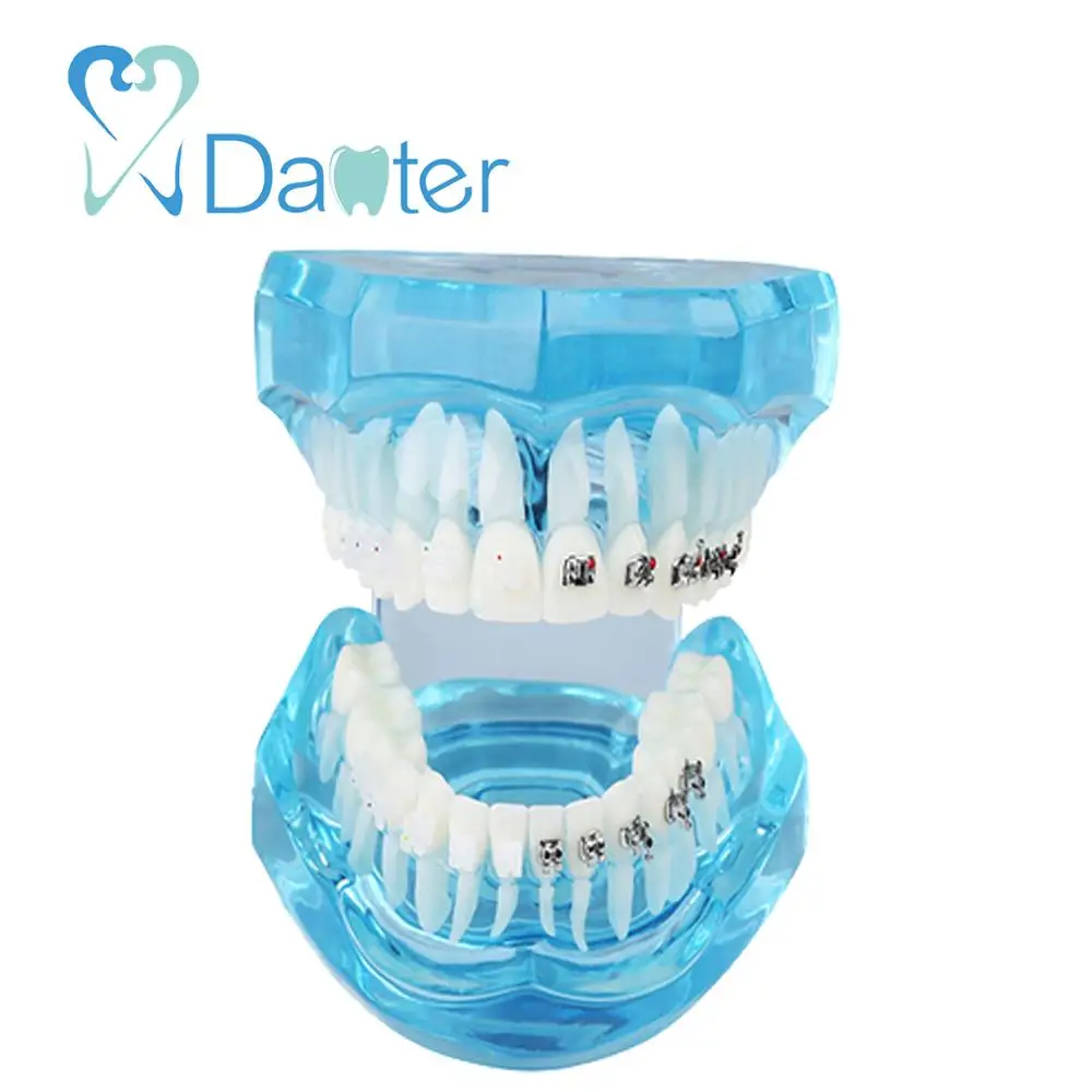 New Arrival Dental Orthodontic Model with Metal and Ceramic Bracket